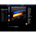 Nuevo escáner de ultrasonido de diagnóstico doppler color portátil con software 3d 4d